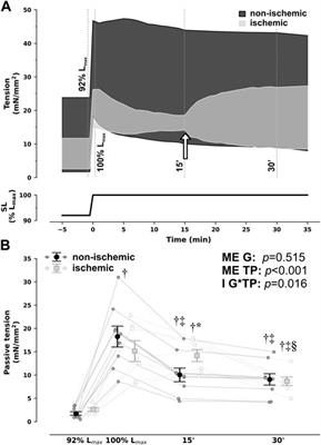 Myocardial stretch-induced compliance is abrogated under ischemic conditions and restored by cGMP/PKG-related pathways